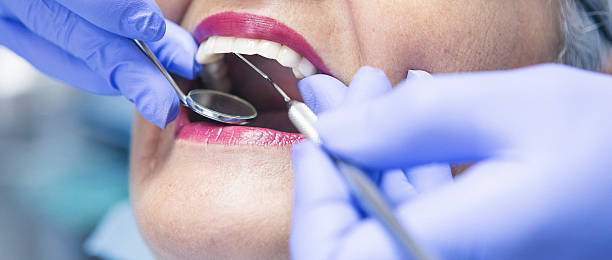 Best Broken or Chipped Tooth Repair in Kerrville, TX