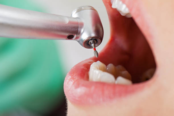 Best Urgent Dental Care for Toothaches in Kerrville, TX